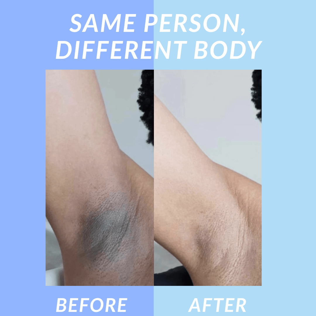 Velara™ Jelly Booster Serum For Dark Spots & Pigmentation