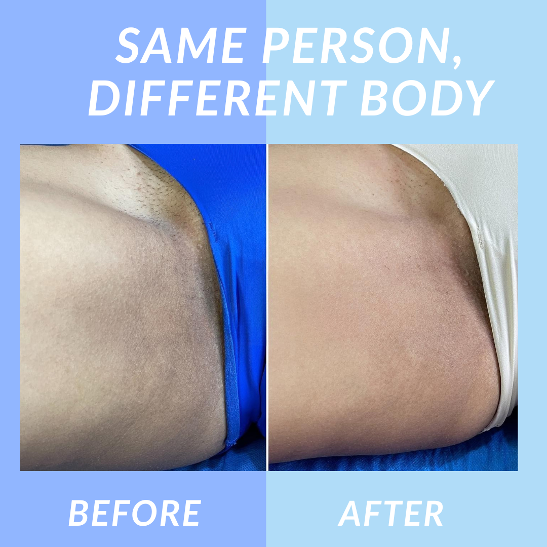 Velara™ Jelly Booster Serum For Dark Spots & Pigmentation