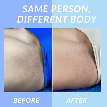 Velara™ Jelly Booster Serum For Dark Spots & Pigmentation