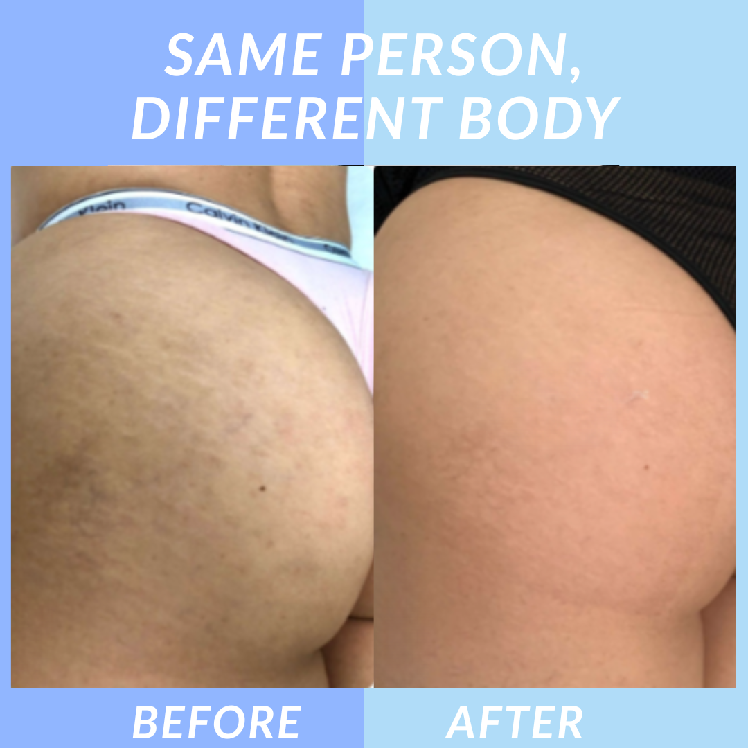 Velara™ Jelly Booster Serum For Dark Spots & Pigmentation